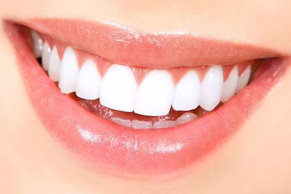 How Long Does Teeth Whitening Take from Grand Valley Dentistry in Allendale Charter Twp, MI
