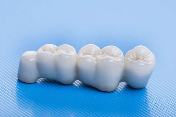 How Many Teeth Can Dental Bridges Replace from Grand Valley Dentistry in Allendale Charter Twp, MI