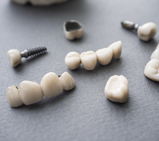 Allendale Charter Twp The Difference Between Dental Implants and Mini Dental Implants