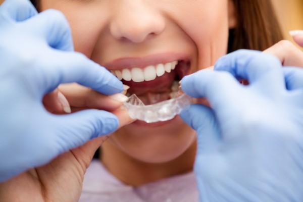 How Invisalign Can Improve Oral Health