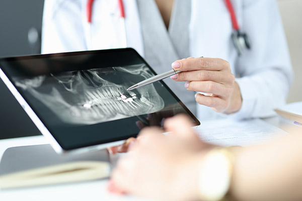 The Importance of Regular Dental Checkup X-Rays from Grand Valley Dentistry in Allendale Charter Twp, MI