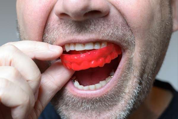 Save Your Teeth by Wearing Mouth Guards at Night from Grand Valley Dentistry in Allendale Charter Twp, MI