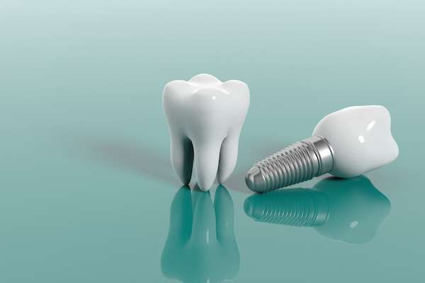 Multiple Teeth Replacement Options: One Implant for Two Teeth from Grand Valley Dentistry in Allendale Charter Twp, MI