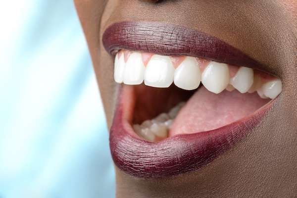 Routine Dental Care: What Are Tooth Colored Fillings from Grand Valley Dentistry in Allendale Charter Twp, MI